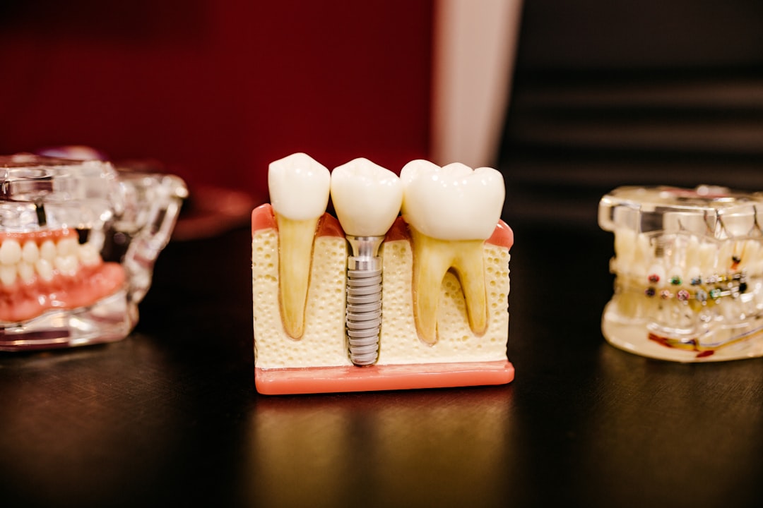 Why Do Teeth Decay Over Time